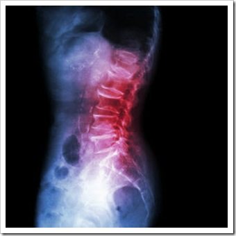 Tigard Back Pain
